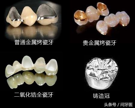 耳垂折痕的相学说法_门牙有缺失的在相学上有什么说法_上门牙缝隙很大说法